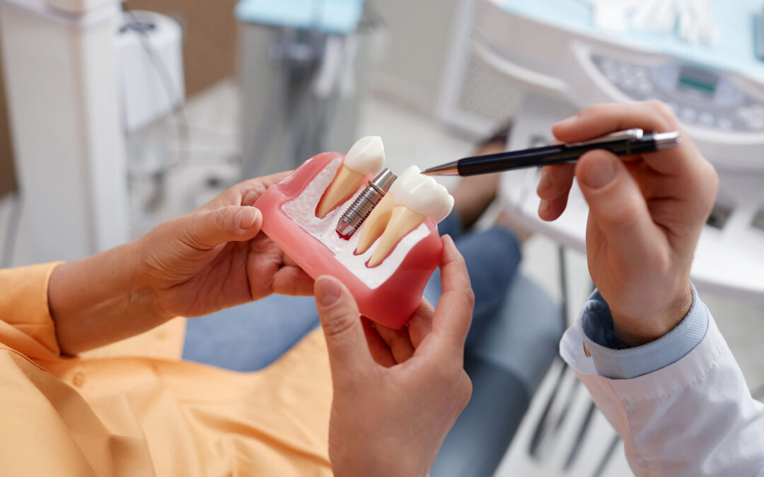 Are Dental Implants Right for You?